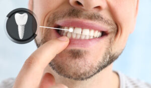 Man showing implanted teeth